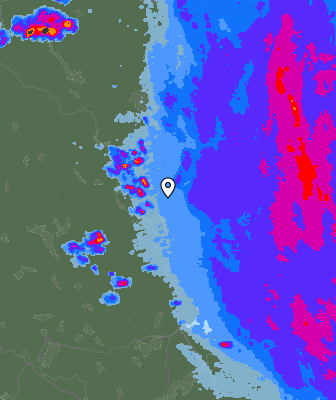 Radar