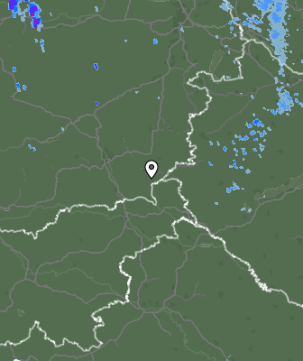 Radar