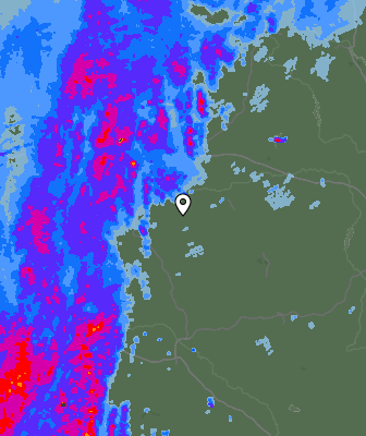 Radar