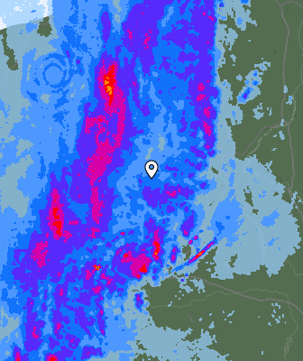 Radar