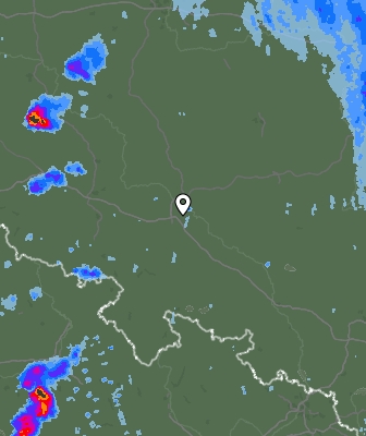 Radar