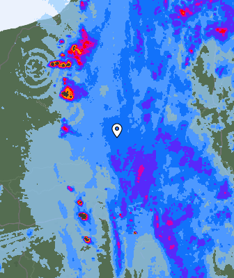 Radar