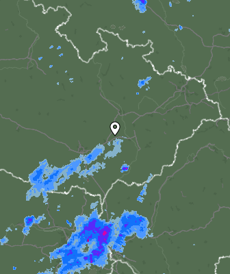 Radar