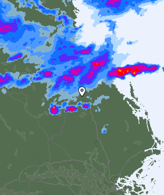 Radar