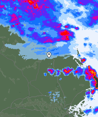 Radar