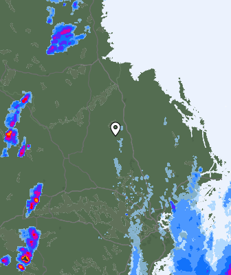 Radar