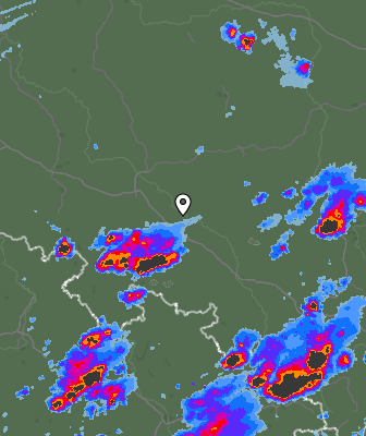 Radar