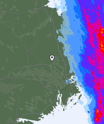 Radar