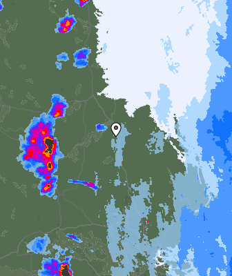 Radar
