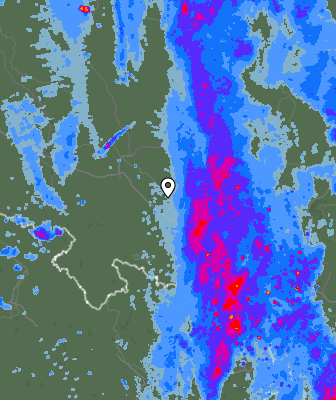 Radar