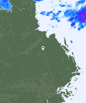 Radar