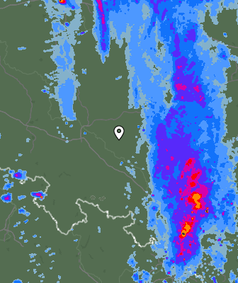 Radar