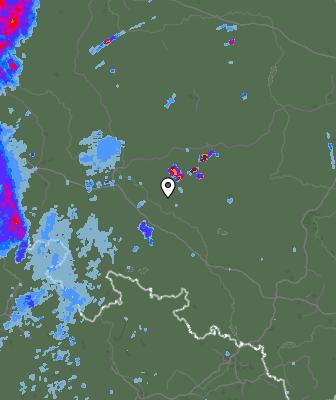 Radar