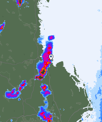 Radar