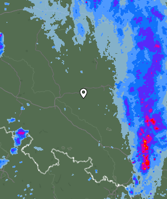 Radar
