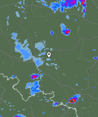 Radar