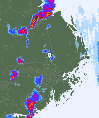 Radar
