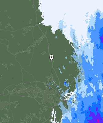 Radar
