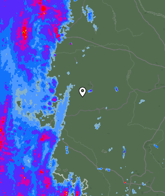 Radar