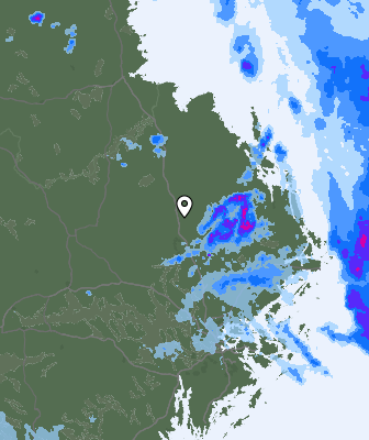 Radar