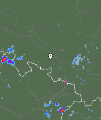 Radar