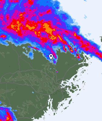 Radar