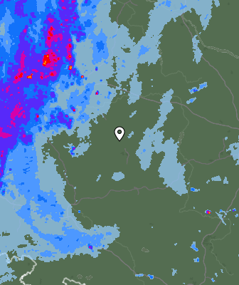 Radar