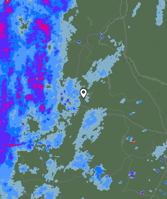 Radar