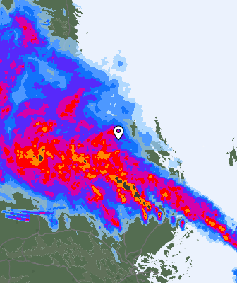 Radar