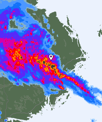 Radar