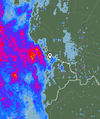 Radar