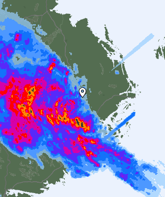 Radar