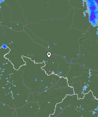 Radar