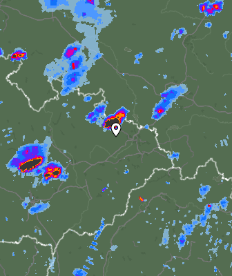 Radar