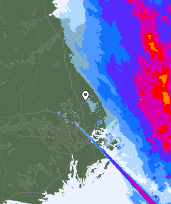 Radar
