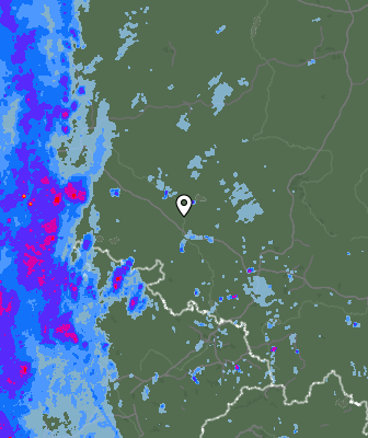 Radar