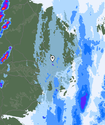 Radar