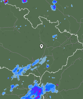 Radar