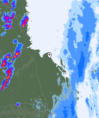 Radar