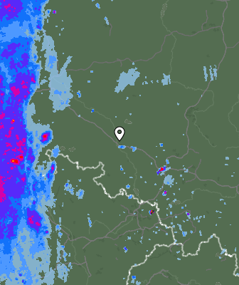 Radar