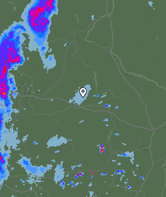 Radar