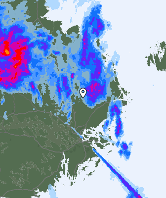 Radar