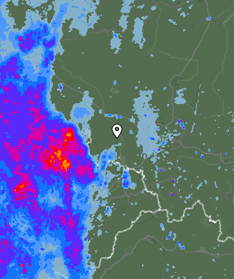 Radar
