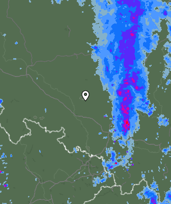 Radar