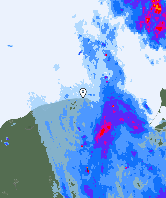 Radar