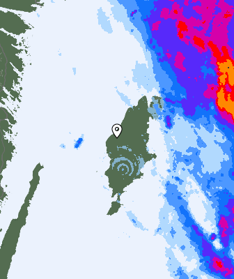 Radar