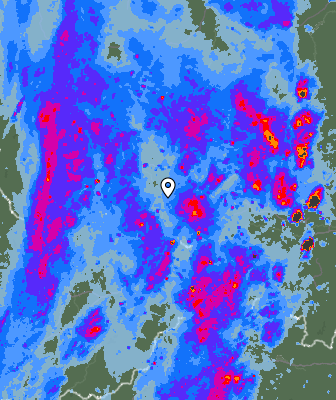 Radar