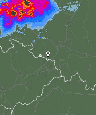 Radar