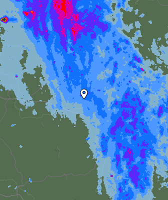 Radar