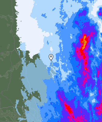 Radar